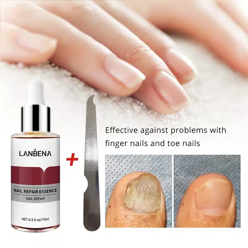 Lanbena Nail Repair Essence Serum – 15ml