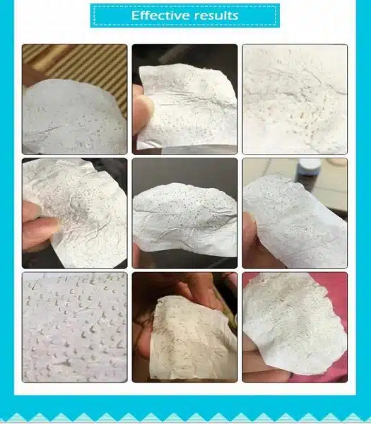 LANBENA Blackhead Remover Nose Plants Pore Strips – 30gm