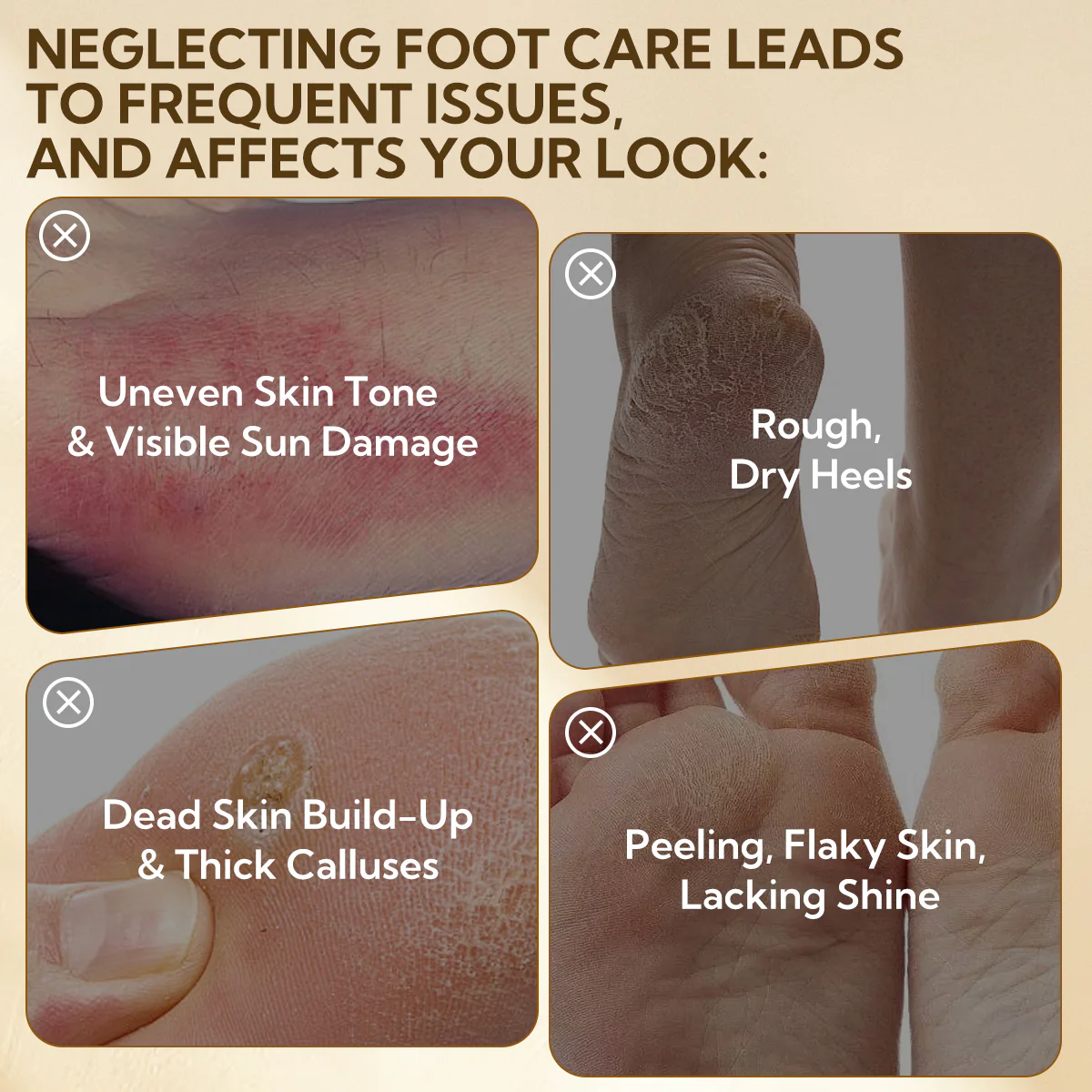 Lanbena Lavender Foot Peel Mask