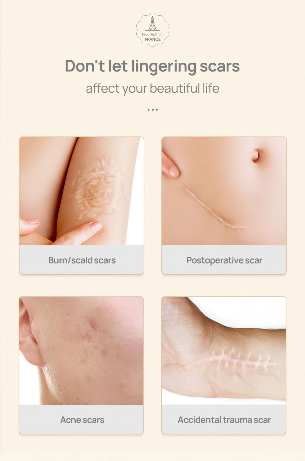 Lanbena Silicone Scar Removal Sheets 1 Piece