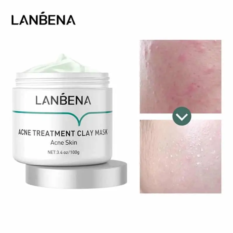 LANBENA ACNE TREATMENT CLAY MASK