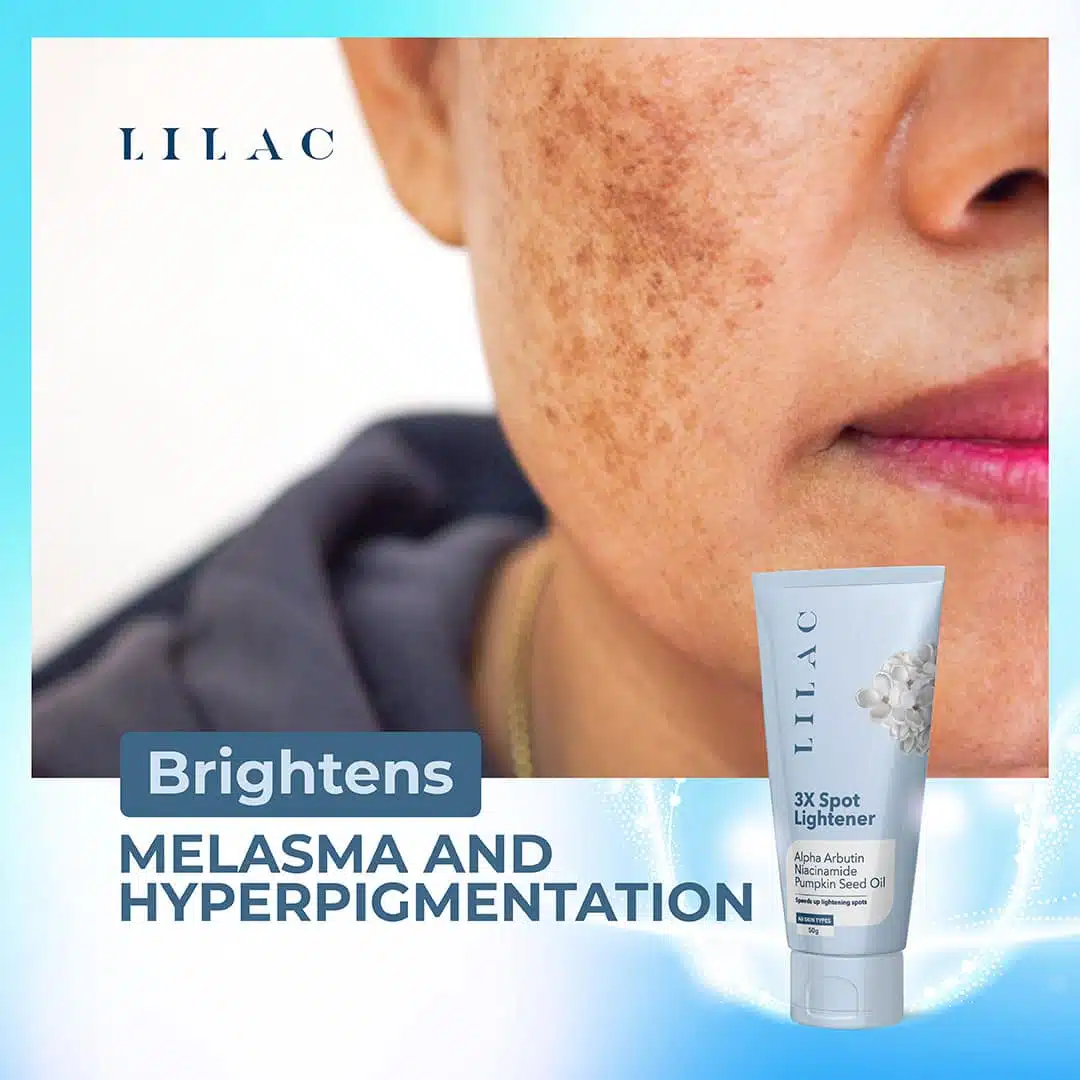 LILAC 3X Spot Lightener Cream – 50g