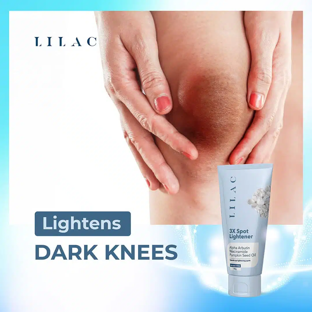 LILAC 3X Spot Lightener Cream – 50g