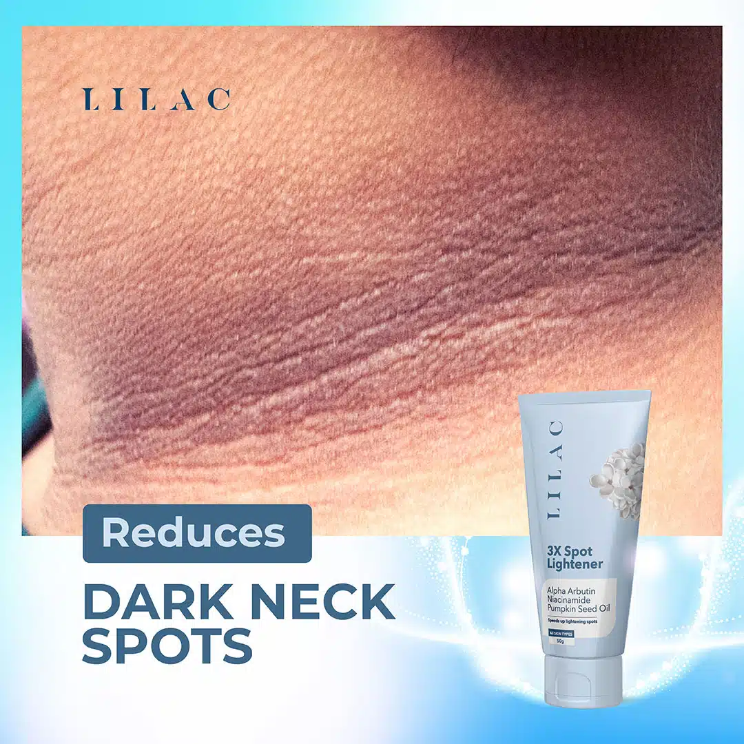 LILAC 3X Spot Lightener Cream – 50g