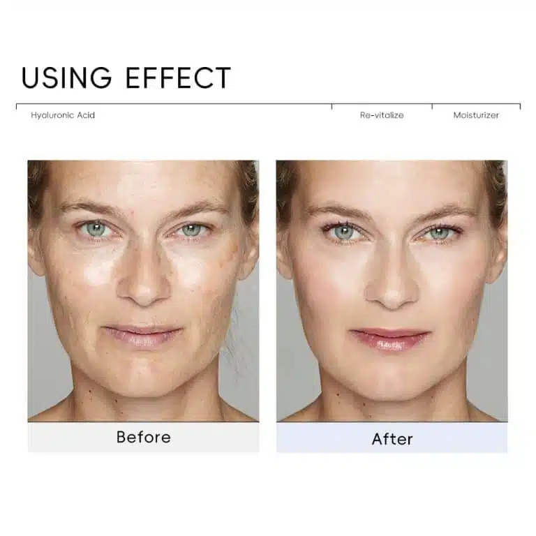 Quiyum Hyaluronic Acid Re-vitalize Moisturizer 30g