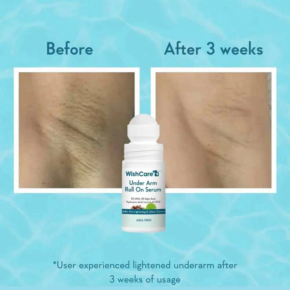 Wishcare Under Arm Roll On Serum – 50ml