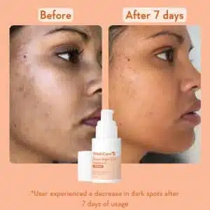 WishCare Super Bright C16 Vitamin C Serum 30ml