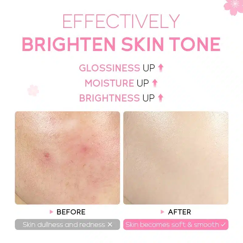 Fenyi Japan Cherry Blossom Serum 17ml