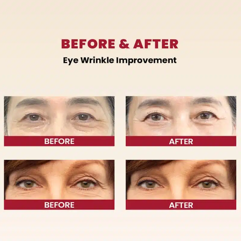 KSECRET SEOUL 1988 Eye Cream Retinal Liposome 4% + Fermented Bean 30ml