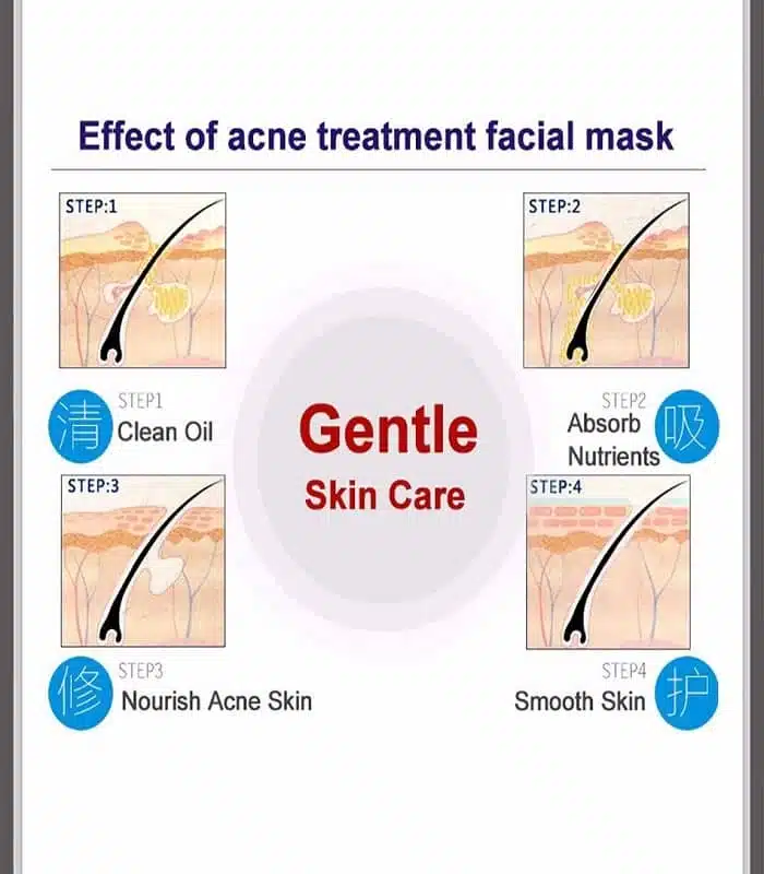 Bioaqua Acne Removal ( Pure Skin ) Acne Rejuvenation Moisturizing Sheet Mask